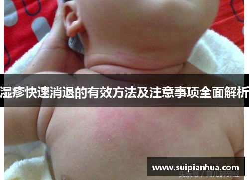 湿疹快速消退的有效方法及注意事项全面解析